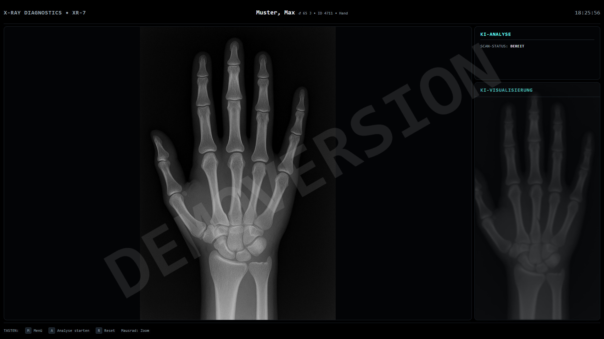 XRAY Röntgen Monitor mit KI Scan